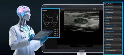 Artemisia Lab IA Ecografia Multiparametrica Tumore